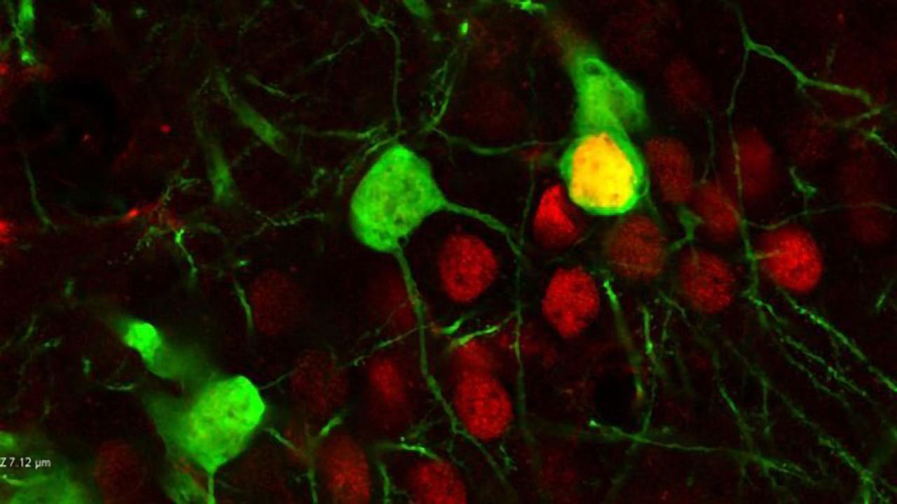 Chronic Cocaine Use Alters Gene Expression in the Mouse Hippocampus