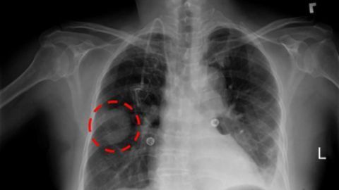 Changing Course: Rethinking How AI Can Interpret X-Rays