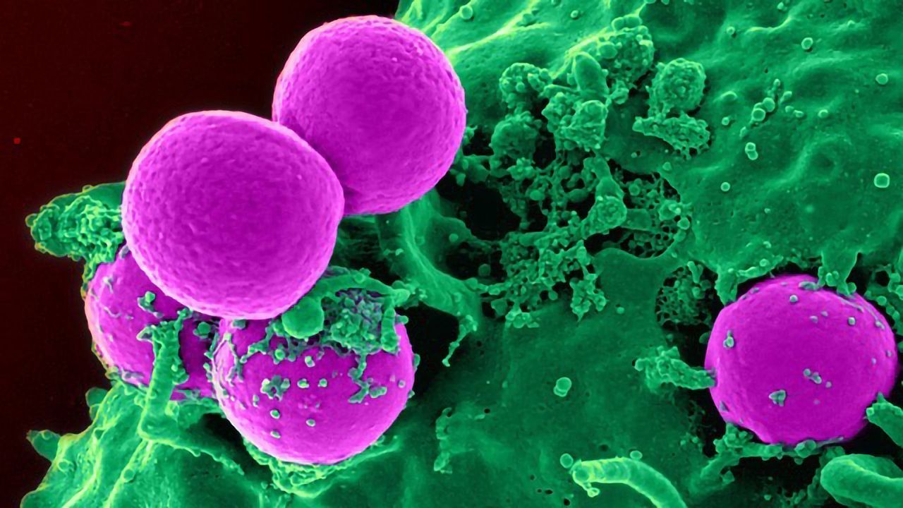 The Impact of Age on Immunotherapy Treatment for Breast Cancer