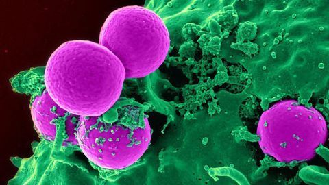 The Impact of Age on Immunotherapy Treatment for Breast Cancer