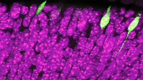 The Genetic Program That Governs the Birth of Vision
