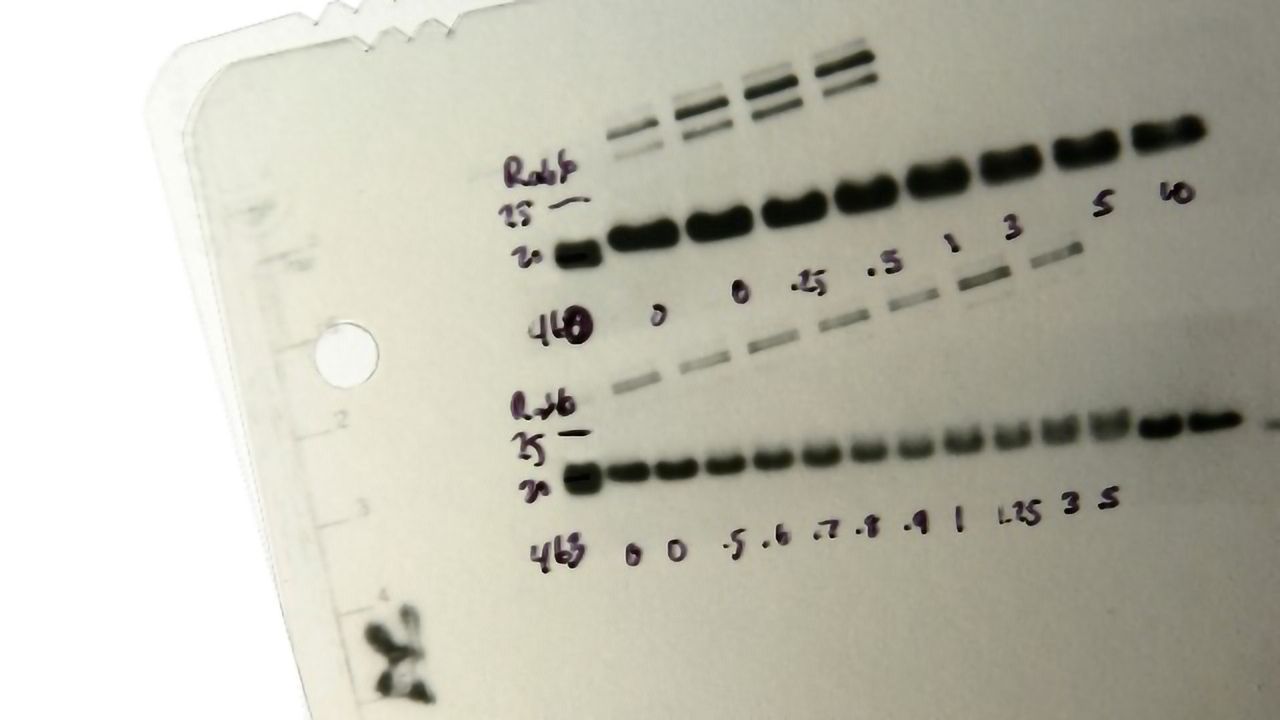 How To Choose the Right Western Blot Detection Method Technology Networks