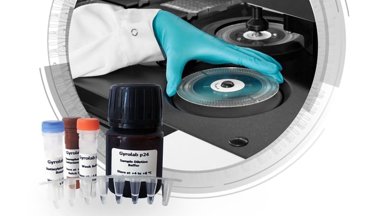 Lentivirus Bioprocessing Kit to Support the Cell and Gene Therapy Market