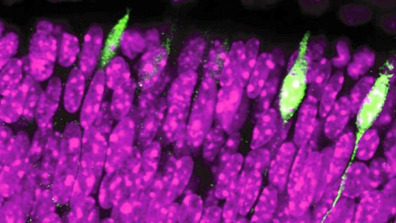 Looking at the Birth of Vision in the Brain