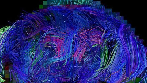 Schizophrenia Onset Prevented in Mouse Model