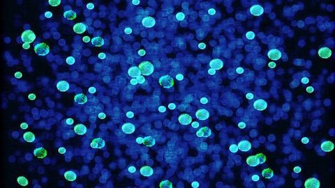Model Identifies Bias of Bacterial Metagenomic Analysis