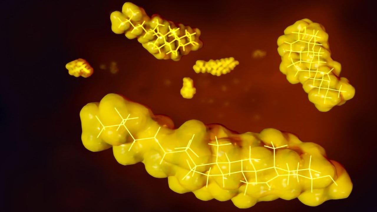 Lipidomics – A Niche but Rapidly Growing Field