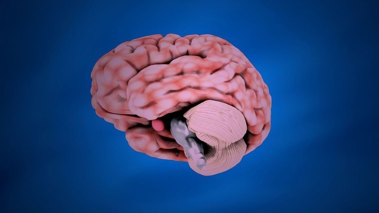 An Overactive Cerebellum Causes Widespread Problems Across the Brain