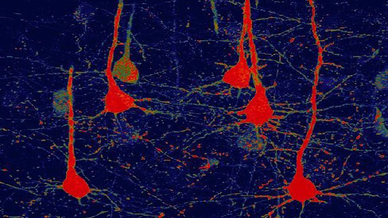 Novel Gene Therapy Is Successful in Improving Functional Recovery After Stroke