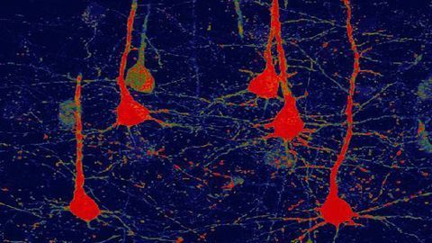 Novel Gene Therapy Is Successful in Improving Functional Recovery After Stroke