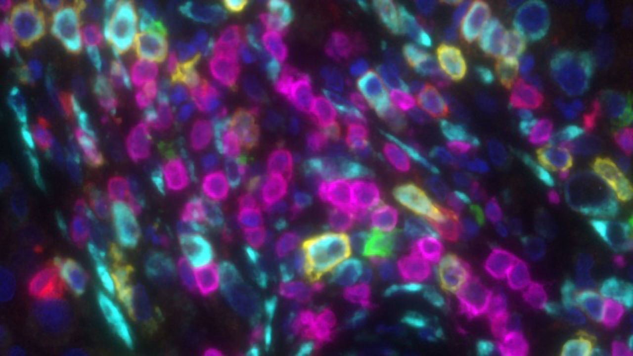 B Cells May Be More Important in Immunotherapy Than Previously Thought