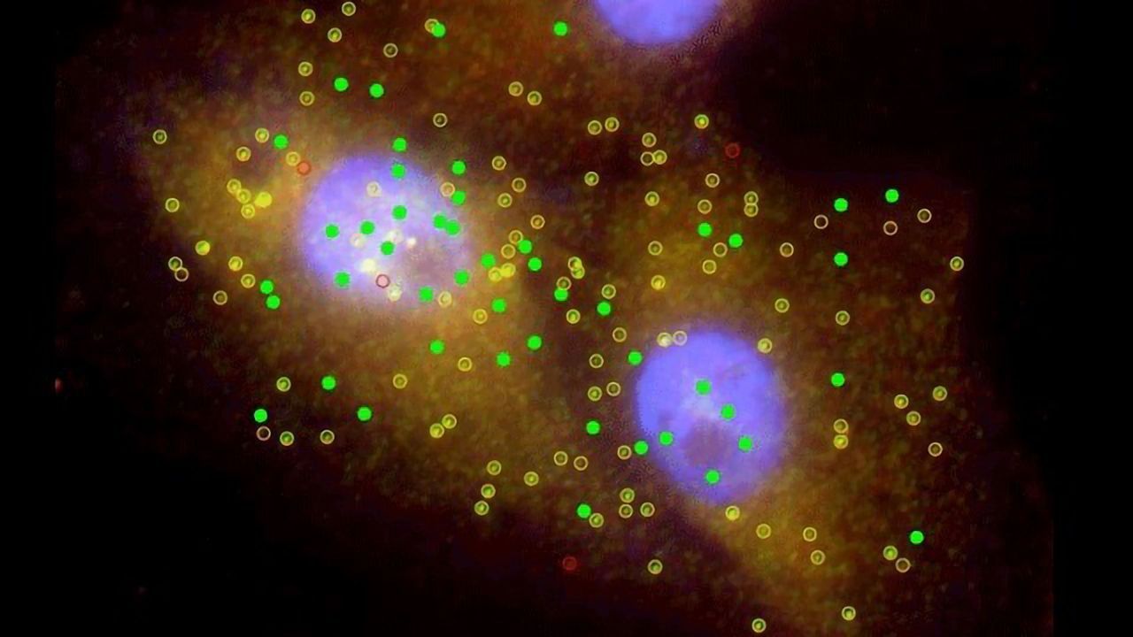 New Insights Into Cancer Progression Uncovered