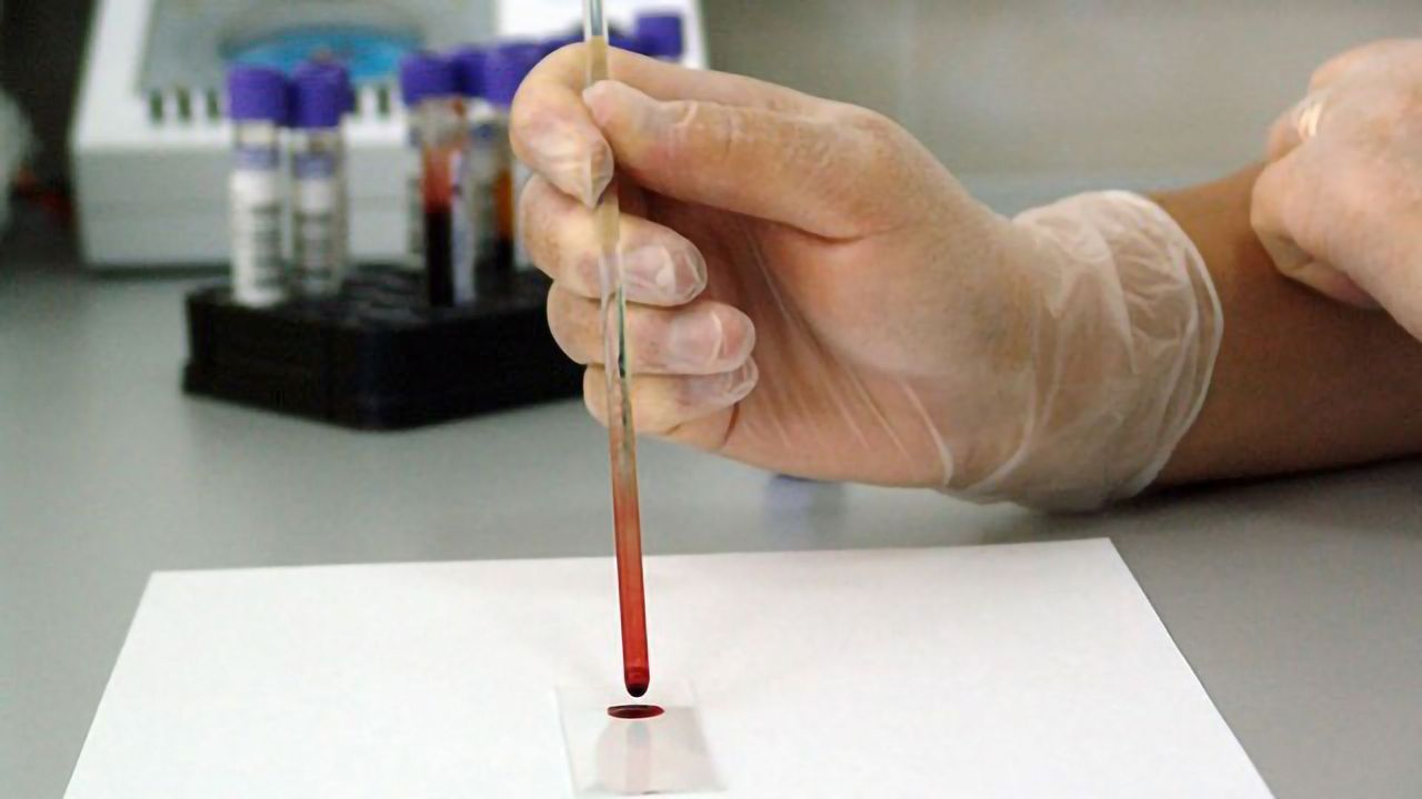 Point-of-care Testing for Early Detection of Sepsis