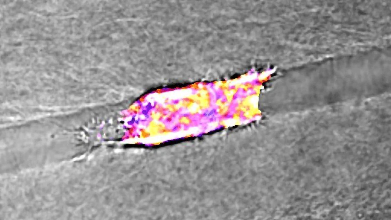 “Lazy” Cancer Cells Choose the Path of Least Resistance