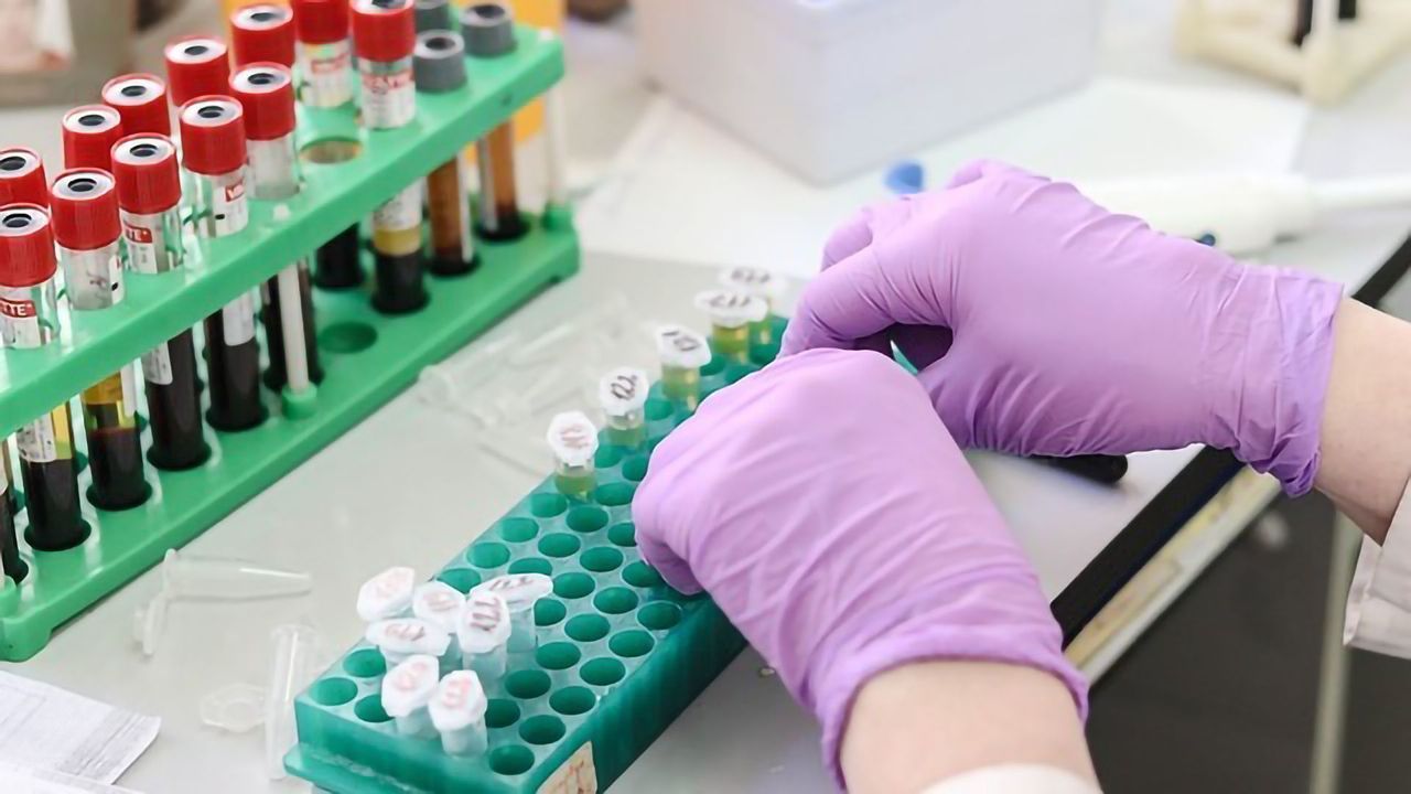 Signals Vital to Immune System's Balancing Act Investigated