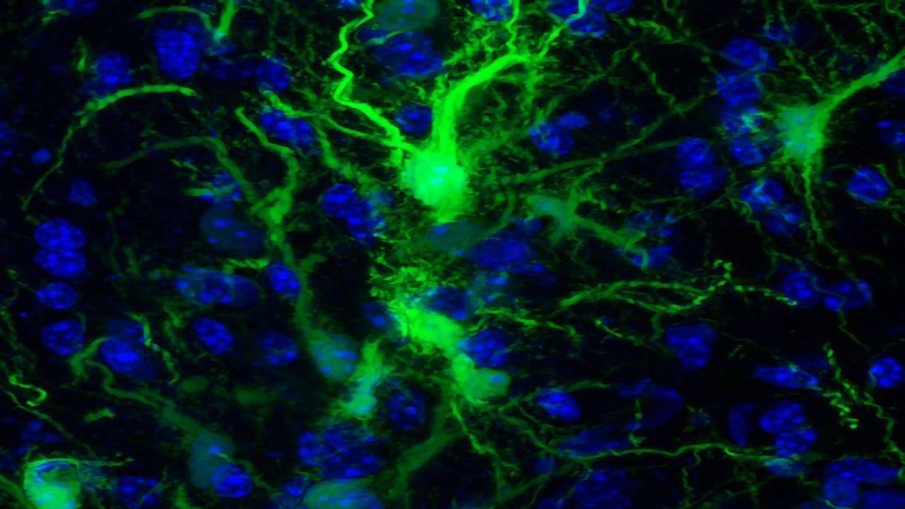 Transplanted Brain Stem Cells Survive in Mice Without Anti-rejection Drugs