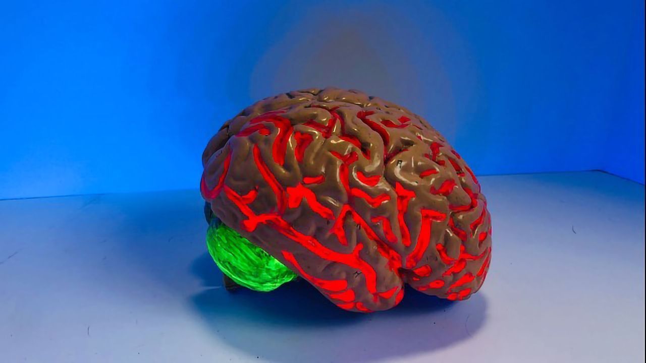 Alzheimer's Risk Gene Impairs Brain's Immune Cells