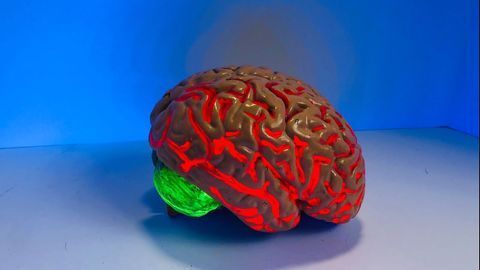 Alzheimer's Risk Gene Impairs Brain's Immune Cells