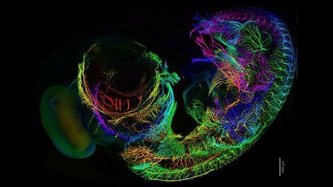 Chicken Embryo Nervous System