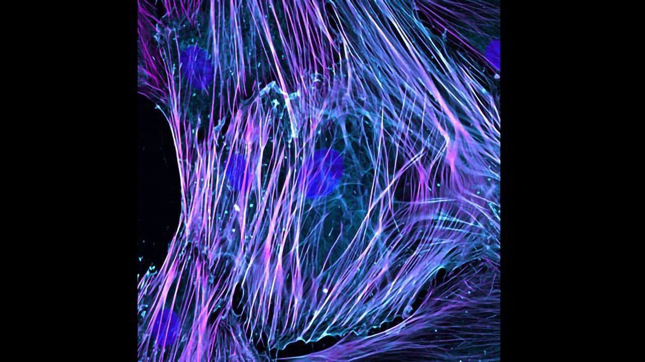 Activated Fibroblasts
