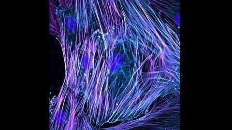 Activated Fibroblasts