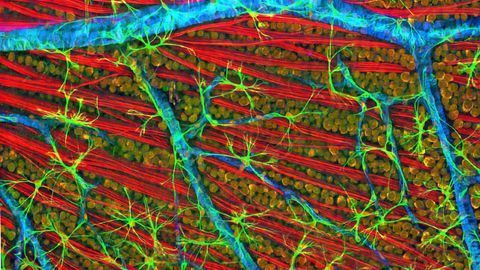 Optic Fiber Layer of a Mouse Retina