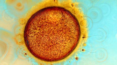 Light Micrograph of Human Ovum (Egg) and Sperm
