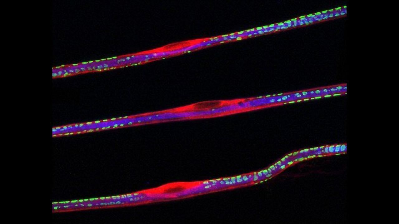 Sciatic Nerve Fibers