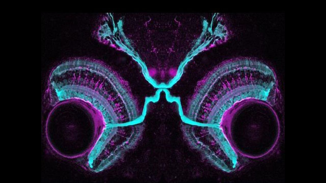 Four-Day-Old Zebrafish Embryo