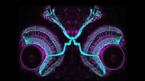 Four-Day-Old Zebrafish Embryo
