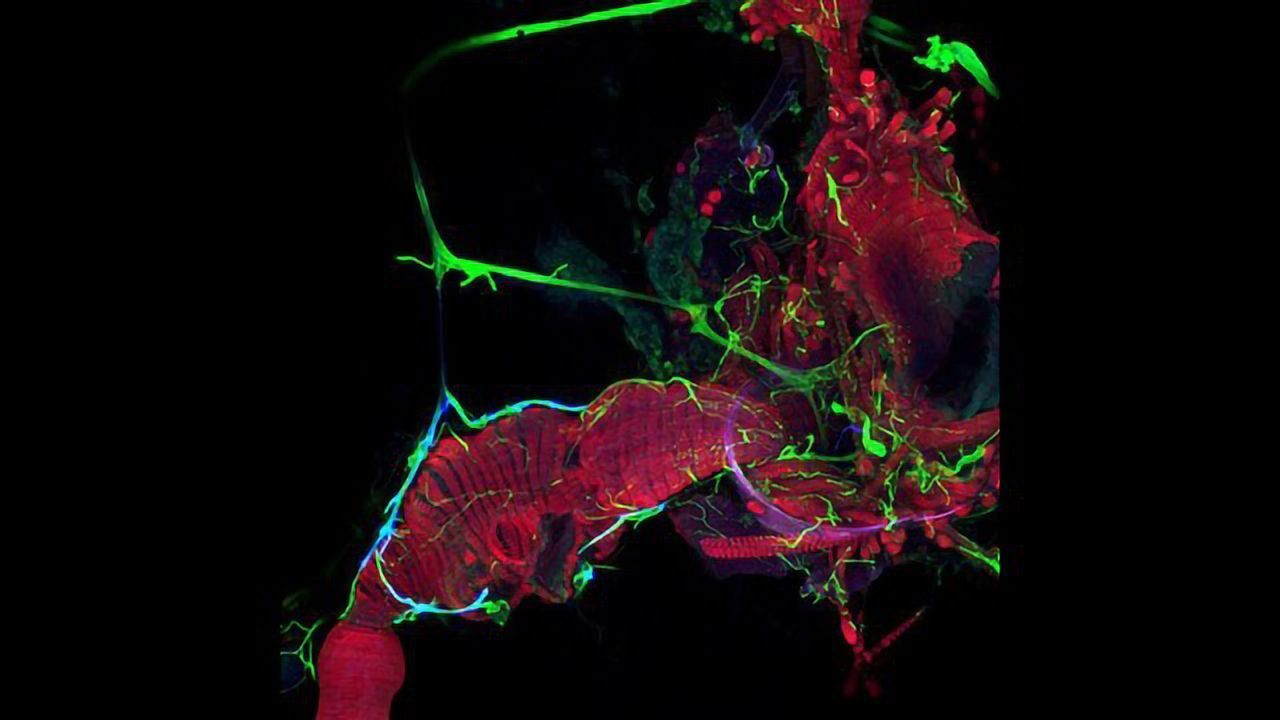 Digestive Tract of an Adult Drosophila fly