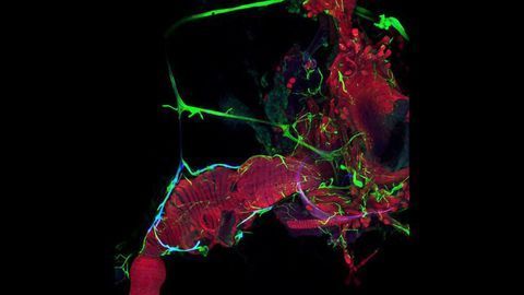 Digestive Tract of an Adult Drosophila fly