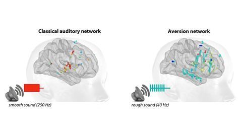 Why Do Harsh Sounds Disturb the Brain?