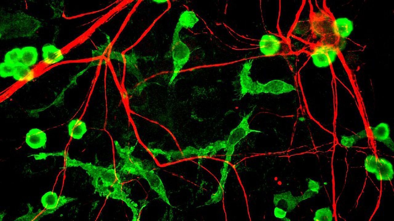 Potential Alzheimer's Drug Target Could Combat Disease on Two Fronts