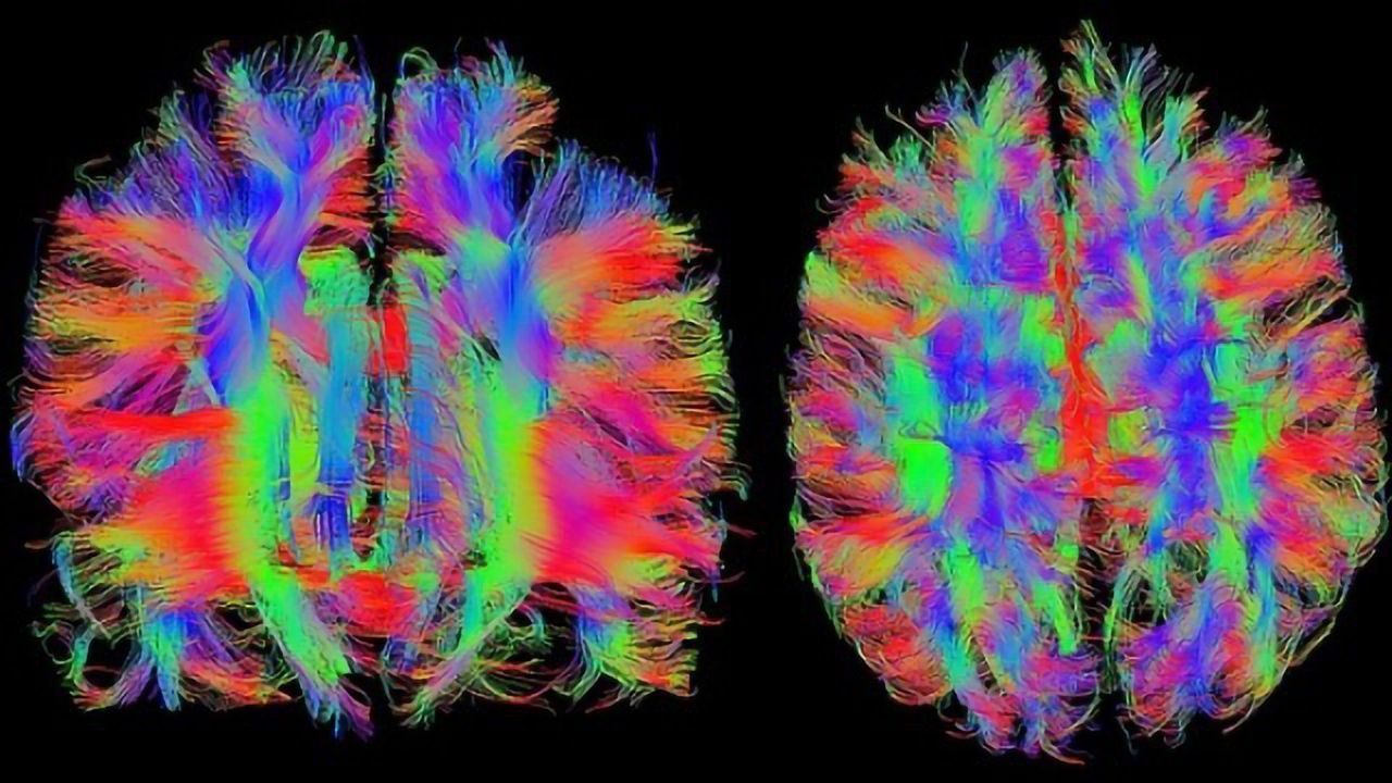 New Study Sheds Light on How the Brain Encodes Information