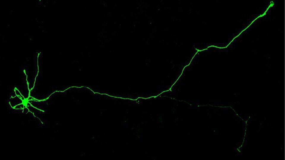 Gene Regulators Work Collaboratively To Determine Schizophrenia Risk content piece image