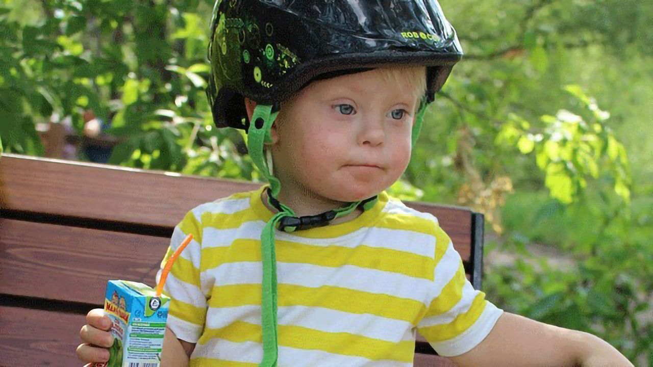 Exploring Blood Cancer Risk in Children With Down Syndrome