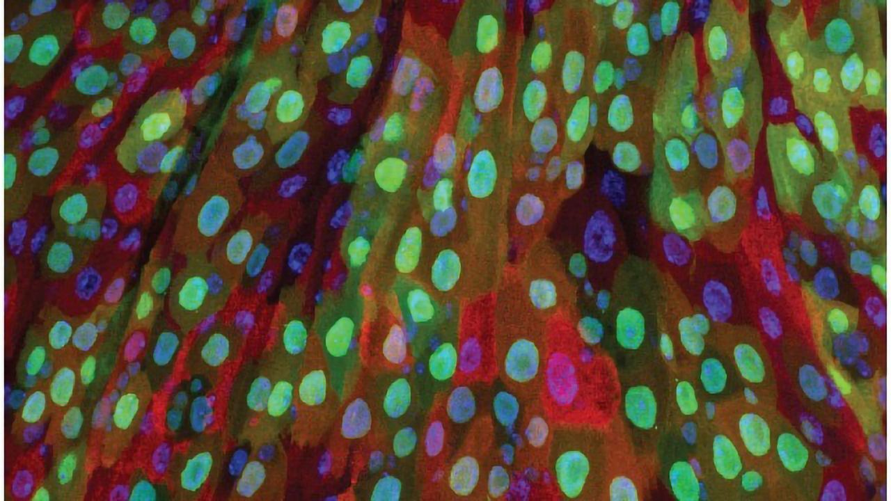 Adult Fly Intestine Could Help Understand Intestinal Regeneration