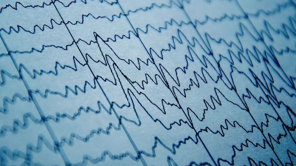 Brain Waves Prove Ineffective for Predicting Epileptic Seizures content piece image