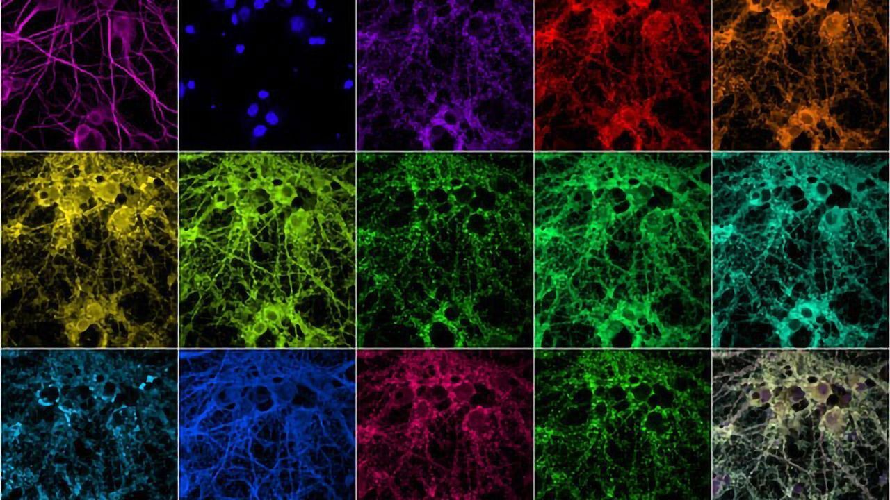 Imaging Synapses