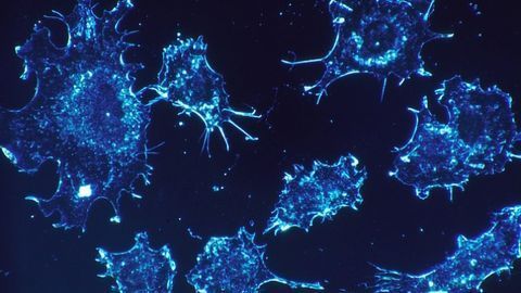 Novel Method Tackles Drug-resistant Cancer Cells