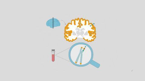 Cellular Aging Is Accompanied by Changes in Our Brain Structure