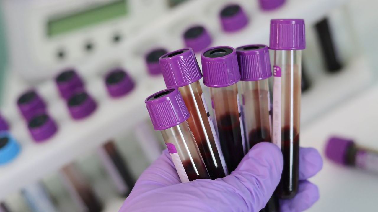 New Blood Test Capable of Detecting Multiple Types of Cancer