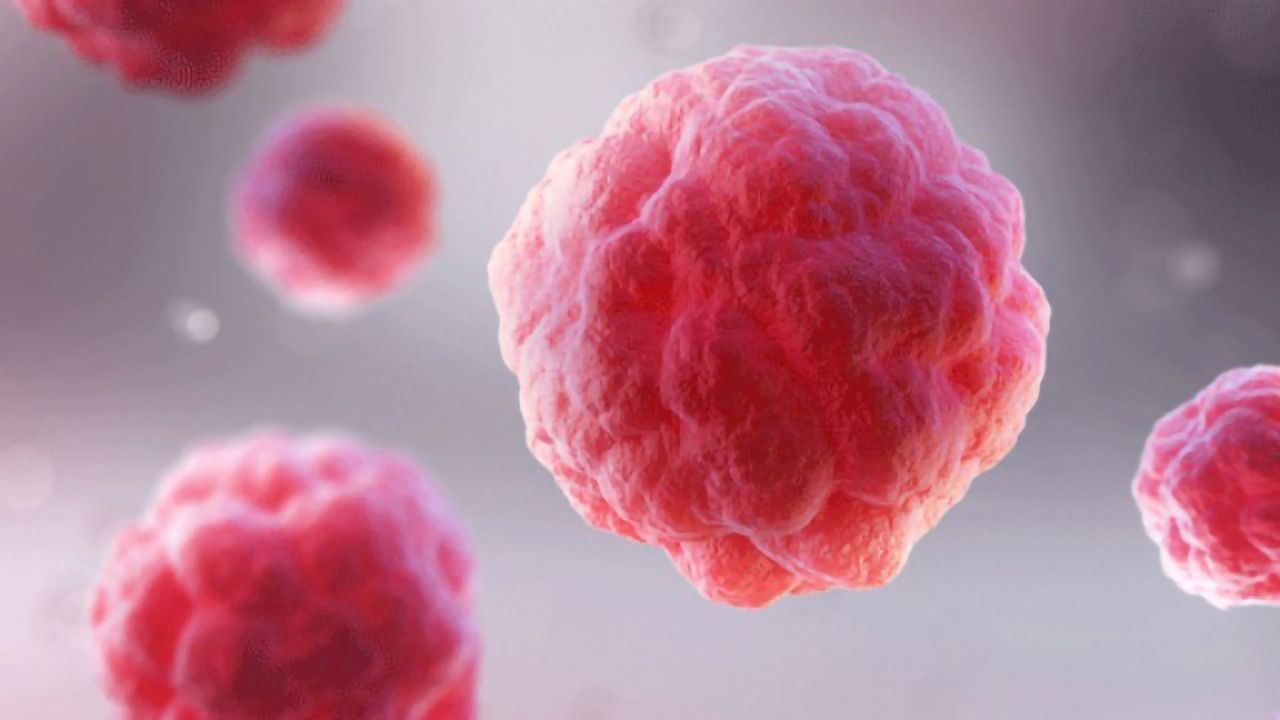 Immune Therapy Destroys Cancer Cells in Early Triple Negative Breast Cancer