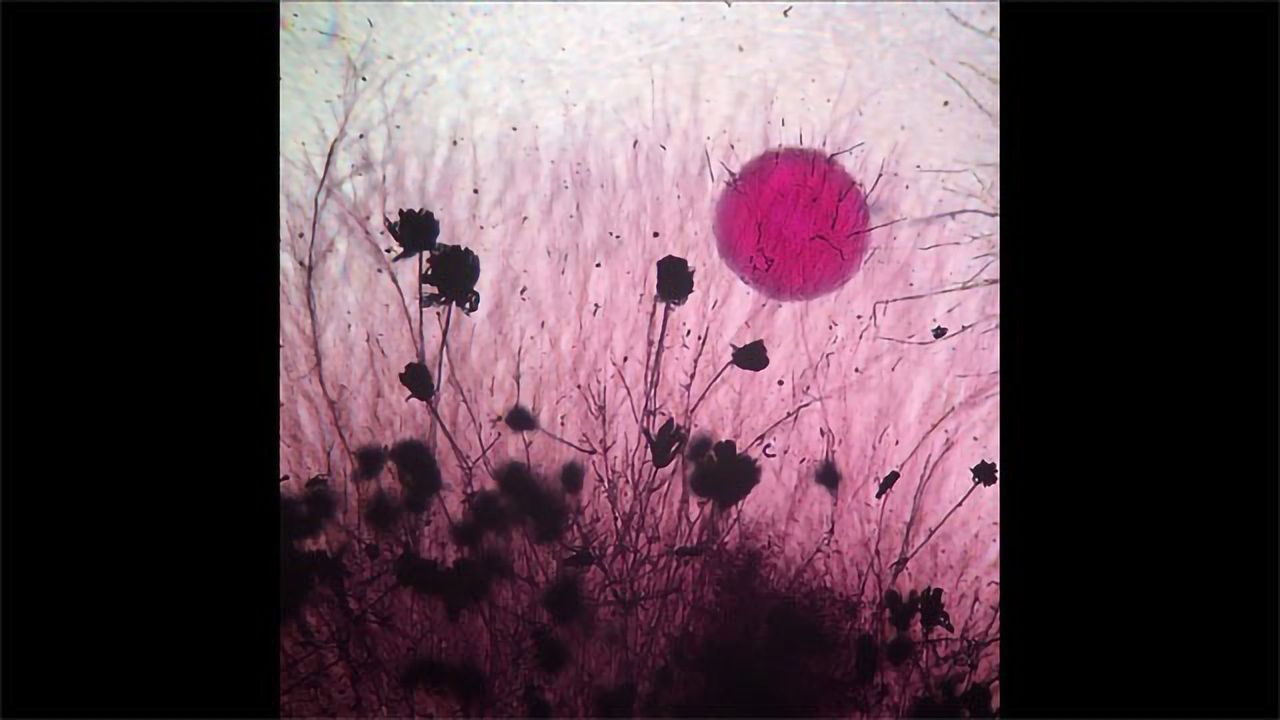 Yeast and Fungi