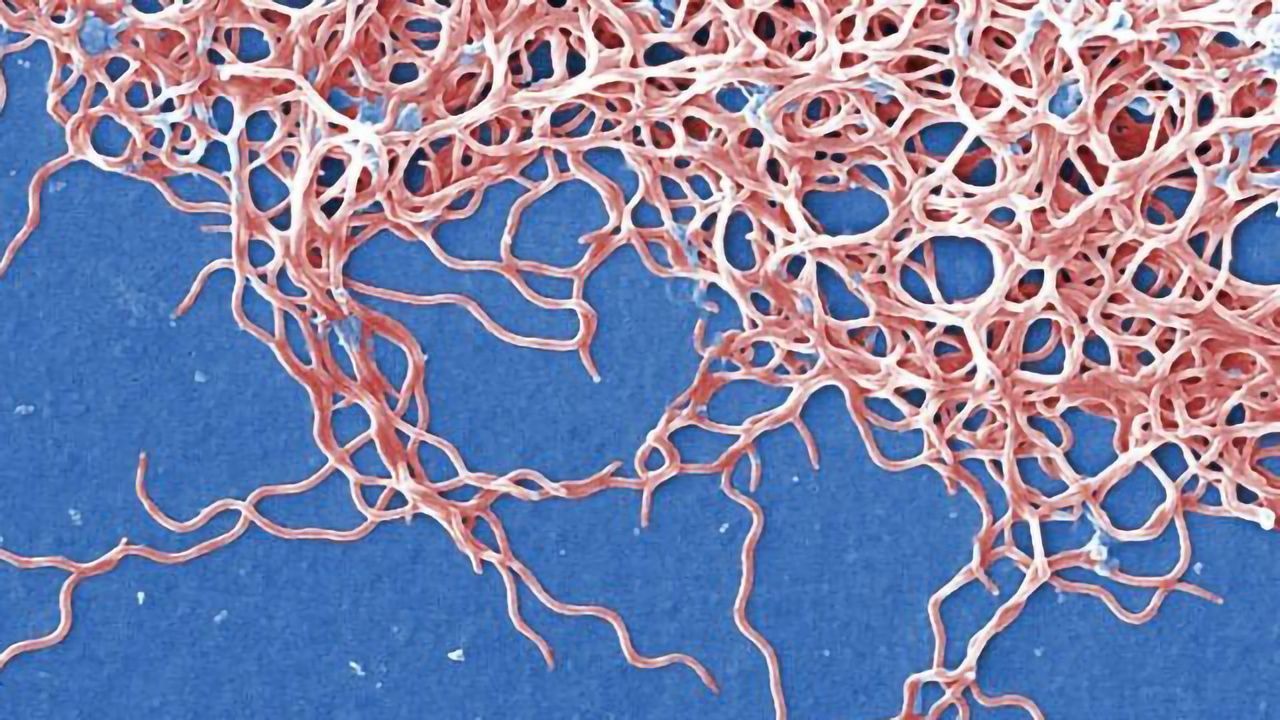 Lyme Disease