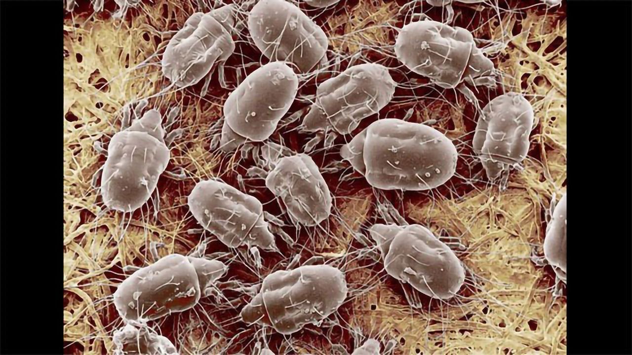 Ham Mites