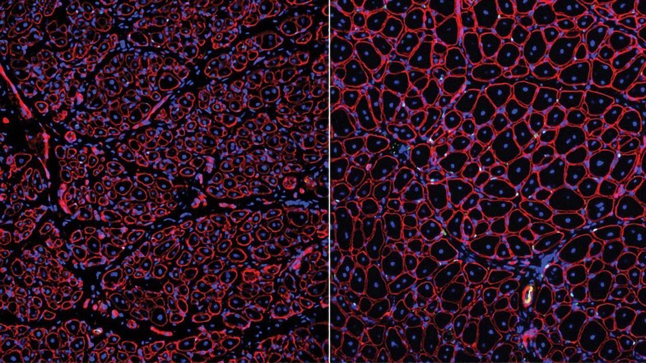 Culprit for Age-related Decline in Muscle Healing Uncovered