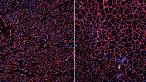 Culprit for Age-related Decline in Muscle Healing Uncovered