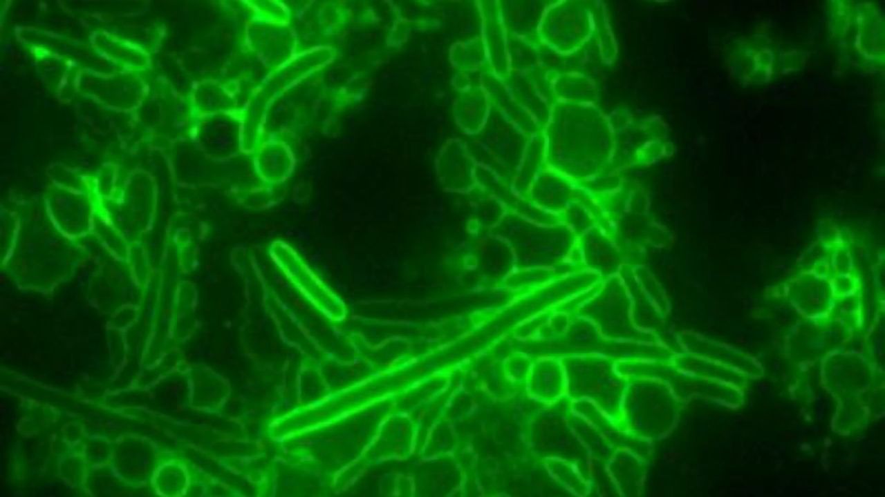 "Poisoned Arrowhead" Used by Warring Bacteria Could Lead to New Antibiotics